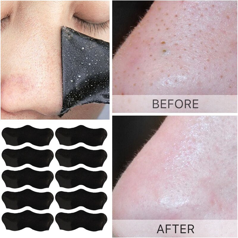 Unisex Blackhead Mask Peel Nasal Strips